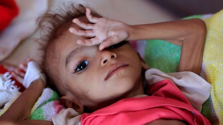 How to stop pending famine in Yemen?