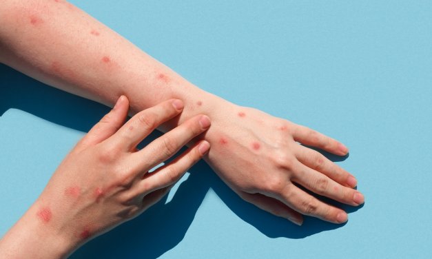 Monkeypox: Opportunity to learn from Islamic health protective system